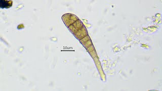 Growing of hyphae and septa formation in Alternaria sp  fast time lapse [upl. by Etterual]