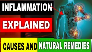 Inflammation Explained Causes amp Natural Remedies [upl. by Goulder]