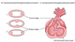 Embryology of the Heart  bulbus cordis ventricles and truncus arteriosus Dr Ahmed Farid [upl. by Erdua]