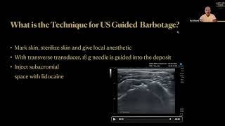 How To Treat Calcific Rotator Cuff Tendinopathy Ultrasound Guided Barbotage and PRP Injection [upl. by Ydiarf]