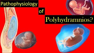 Pathophysiology of Polyhydramnios During Pregnancy [upl. by Goldshlag]