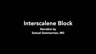 Interscalene Block  Ultrasound [upl. by Owiat795]