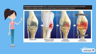 CoActivation muscle [upl. by Chow]