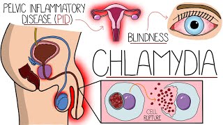 Understanding Chlamydia Chlamydia Trachomatis Explained Clearly [upl. by Mclyman734]