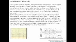 Understanding EEG Part 6Machine used in EEG diagnostic application signal recorded clinical use [upl. by Robinetta]