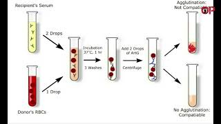 What is Cross matching its Types  procedure and interpretation [upl. by Sair968]