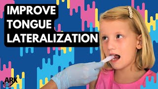 Improve Tongue Lateralization with ARKs OroNavigator™ [upl. by Urban864]