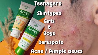 Facewash for acne  Acnes facewash review  pimple solution face wash Acne treatment [upl. by Ativel]