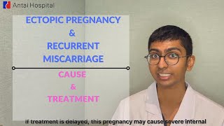 Ectopic Pregnancy amp Recurrent Miscarriage │Ectopic Pregnancy Explained │Antai Hospital [upl. by Yelda203]