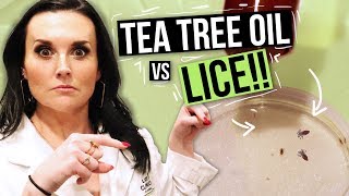 Removing LICE with TEA TREE OIL  Watch this Before You Try [upl. by Jannery]