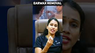 All About Earwax Symptoms Causes Treatment and Expert Tips  Dr Devipriya in Tamil Short 3 [upl. by Aihsoj]