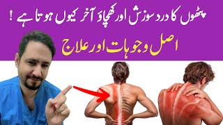 Myalgia Muscle Pain Treatment In Urdu Hindi  Dr Irfan Azeem [upl. by Nehttam]