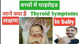 newborn babies Thyroid symptoms and treatment ৷ congenital hypothyroidism [upl. by Quar]