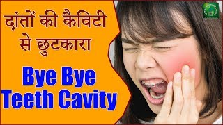 How To Get Rid Of Tooth Cavity  दांतों की कैविटी से छुटकारा दिलाते हैं ये 5 घरेलू उपचार [upl. by Ajssatan]