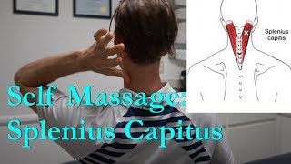 Self Massage Splenius Capitus back of neck [upl. by Janie]