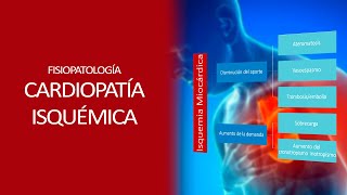 Fisiopatología  Isquemia miocardica [upl. by Mendes133]