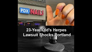 Woman Claims Acrylic Manicure Gave Her Herpes info360 [upl. by Particia]