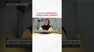 APAKAH OKRONOSIS TIDAK DAPAT DIOBATI clinicdevotrepeau treatmentwajah [upl. by Aihsei596]