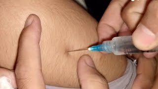 Injection lagane ka tarika  how to give intramuscular injection  nursing school Ep02 [upl. by Reichel]