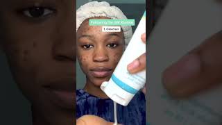 MDacne  Custom Acne Treatment  Get Your First Kit Free [upl. by Alenson]