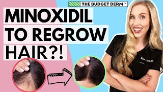 Minoxidil For Hair Loss  Everything you need to know [upl. by Jolee]