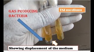 Gas producing bacteria The simplest way of identification  Fully practical Microbiology [upl. by Idas758]