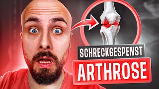 Die 3 größten Mythen über Arthrose [upl. by Ibrad]