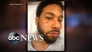 Chicago police chief speaks out on Jussie Smollett case [upl. by Aurelio]