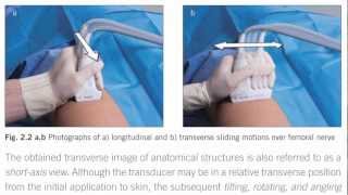 Ultrasound Guidance for Vascular Access and Regional Anesthesia by Dr Brian Pollard 12 [upl. by Caprice]