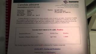 Immuno Bloodprint Test Results Review [upl. by Yvette336]