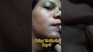 Day7 Using Tretinoin Cream 0025 tretinoin viralvideo skincare [upl. by Oxford]