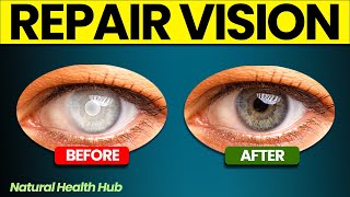 6 Natural Supplements to Repair Vision [upl. by Hillel839]