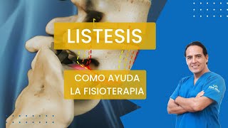 ¿SE CURA LA LISTESIS CON FISIOTERAPIA  ❤ Se amable y califique nuestro trabajo 👍 [upl. by Eyssej697]