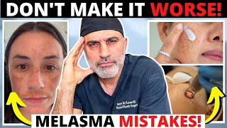 Melasma mistakes that can ruin your skin and make hyperpigmentation worse [upl. by Dirfliw]