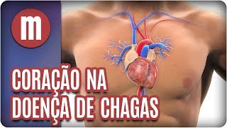 Coração na Doença de Chagas  Mulheres 260917 [upl. by Eelirem]