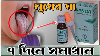 Nystat Oral Suspension।।How To Use Nystat।।মুখের ঘা দূর করার সেরা ঔষধNystst Drop [upl. by Jenkel]