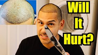 Removing Hair Transplant Scabs With Butter Knife [upl. by Nuhsal]