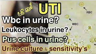 Wbcleukocytespus cellsin urine  Urine culture amp sensitivity  causes of Uti urduhindi [upl. by Sadie]