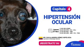 Masterclass 4 Hipertensión ocular [upl. by Nyla]