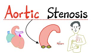 Aortic Stenosis AS  Valvular Heart Disease VHD  Causes Symptoms Diagnosis Treatment Cardio [upl. by Dalpe]