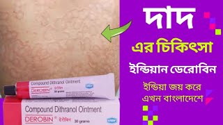 দাদ এর চিকিৎসা।। দাউদ এর চিকিৎসা।। দাদ এর মলম।। ডেরোবিন মলম।। Derobin cream dad ar molom [upl. by Tarton]