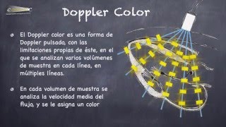 CONOCIMIENTOS BÁSICOS EN ECOGRAFÍA – EL ODIOSO DOPPLER [upl. by Nwahsad]