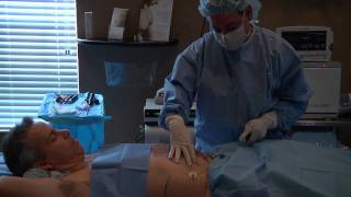 Vaser Liposuction  SmartLipo [upl. by Montagna]