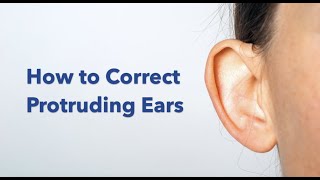 Otoplasty ear pinning surgery explained [upl. by Nwahsit]