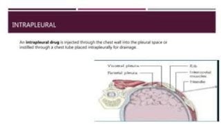 Intrapleural Route of Drug Administration  Purpose Why it is done and Procedure [upl. by Attebasile107]