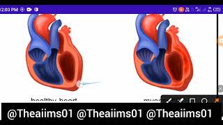 Myocarditis Heart diseases MNS topic for NORCET preparation Bsc nursing Gnm ANM competitive exams [upl. by Ahseyi]