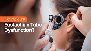 How to cure Eustachian Tube Dysfunction [upl. by Willman]