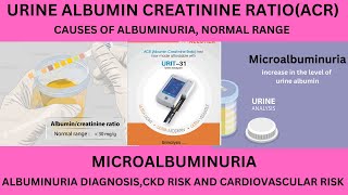 ALBUMIN CREATININE RATIOACR URINE TEST NORMAL RANGEMICROALBUMINURIAPROTEIN CREATININE RATIO [upl. by Ras]