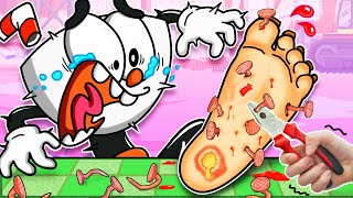 S O S❗ Cuphead Stepped On Nails  How To Athletes Foot Treatment  Poppy Playtime Animation [upl. by Asserak]