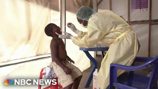 WHO declares global emergency as mpox virus spreads across Africa [upl. by Urbannai644]